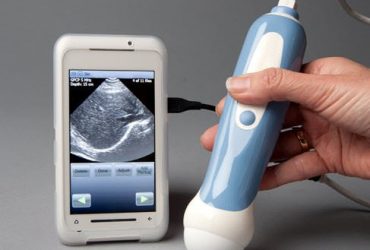 Il primo smartphone medico è di Mobisante 3