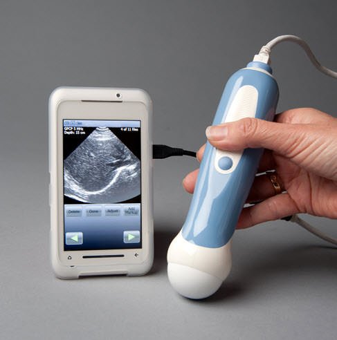 Il primo smartphone medico è di Mobisante 1