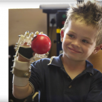 Il braccio robotico low cost per aiutare i bambini 2