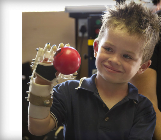 Il braccio robotico low cost per aiutare i bambini 1